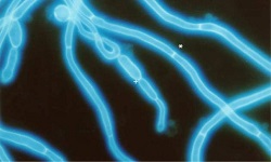 Calcofluor White (CFW) Staining